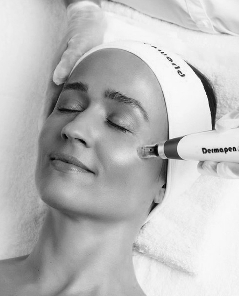 Dermapen Treatment