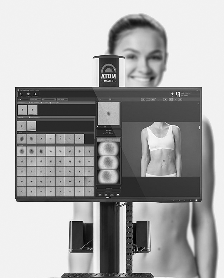 Digital Mole Scanning Treatment