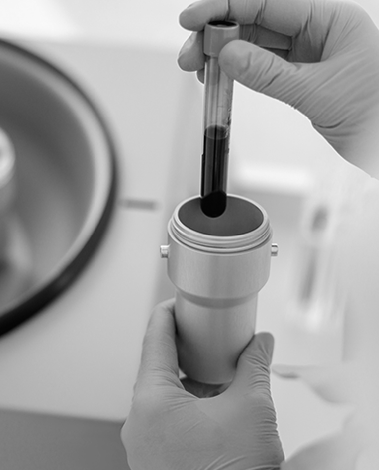 Platelet Therapy Treatment at Dr Jonny